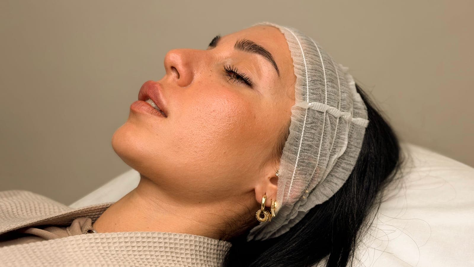 Profile of a client's lips and facial proportions before treatment at ART FACE Clinic