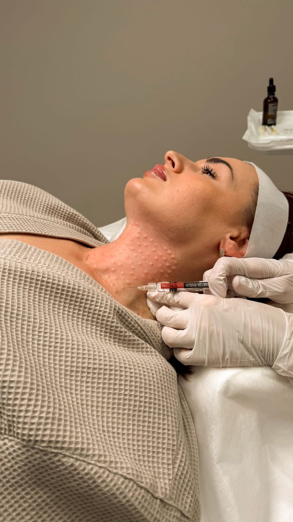 Neck mesotherapy in progress with temporary injection bumps.