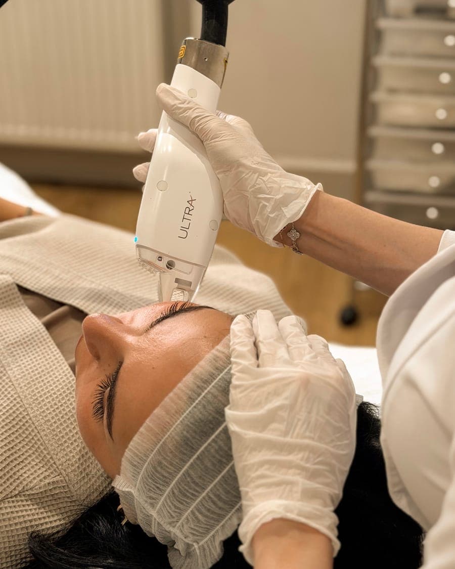 LaseMD Ultra laser handpiece on a client's face at ART FACE London